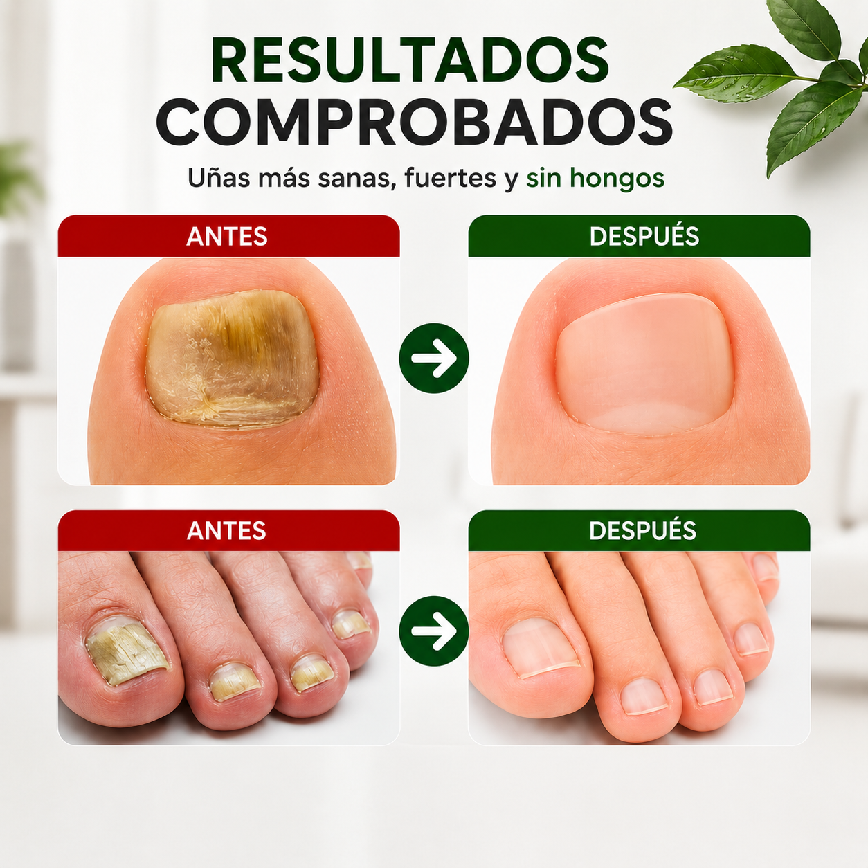 🌿Aceite Anti-hongos Uñas + ¡SOLO POR HOY PAGA 1 Y LLÉVATE 2!🔥