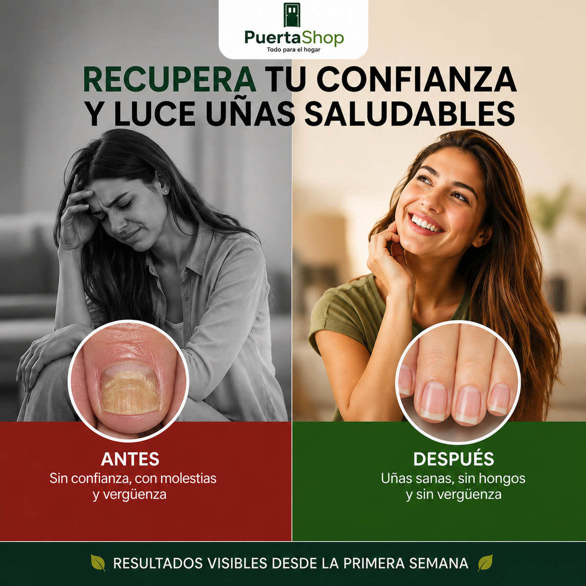 🌿Aceite Anti-hongos Uñas + ¡SOLO POR HOY PAGA 1 Y LLÉVATE 2!🔥